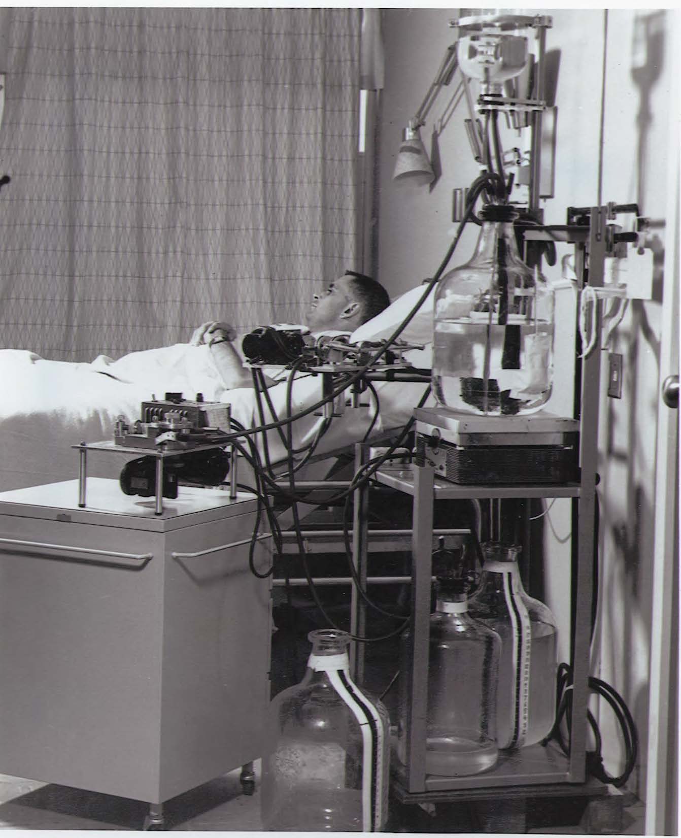 First peritoneal dialysis machine, 1960s