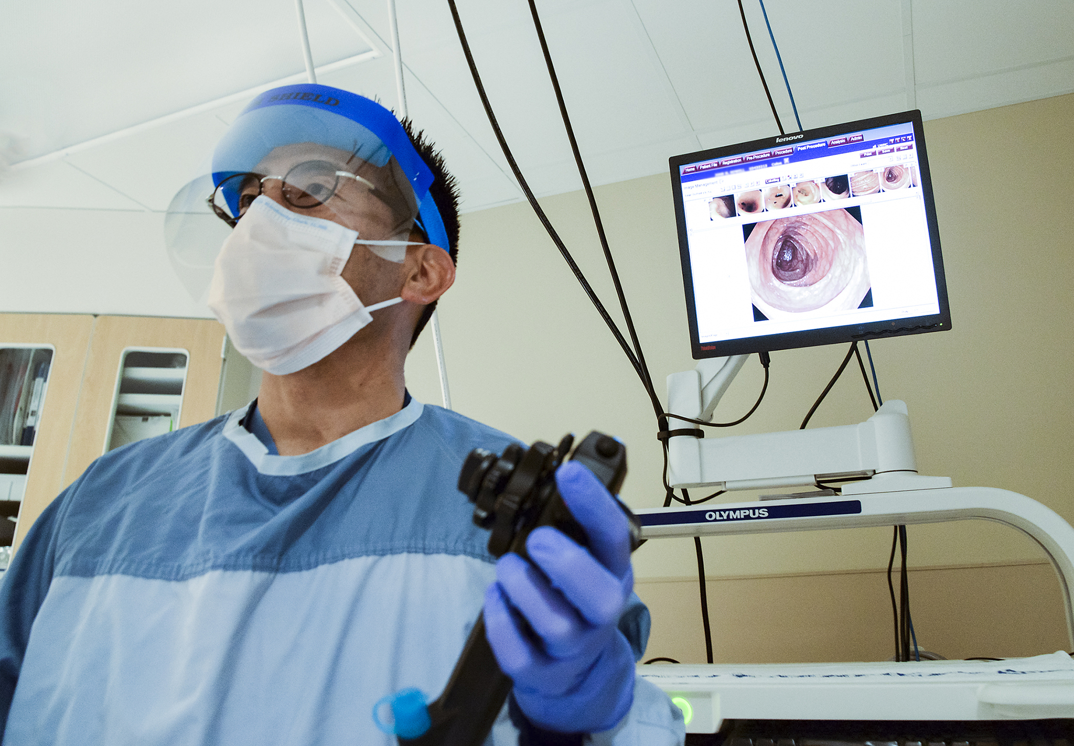 Colonoscopy procedure