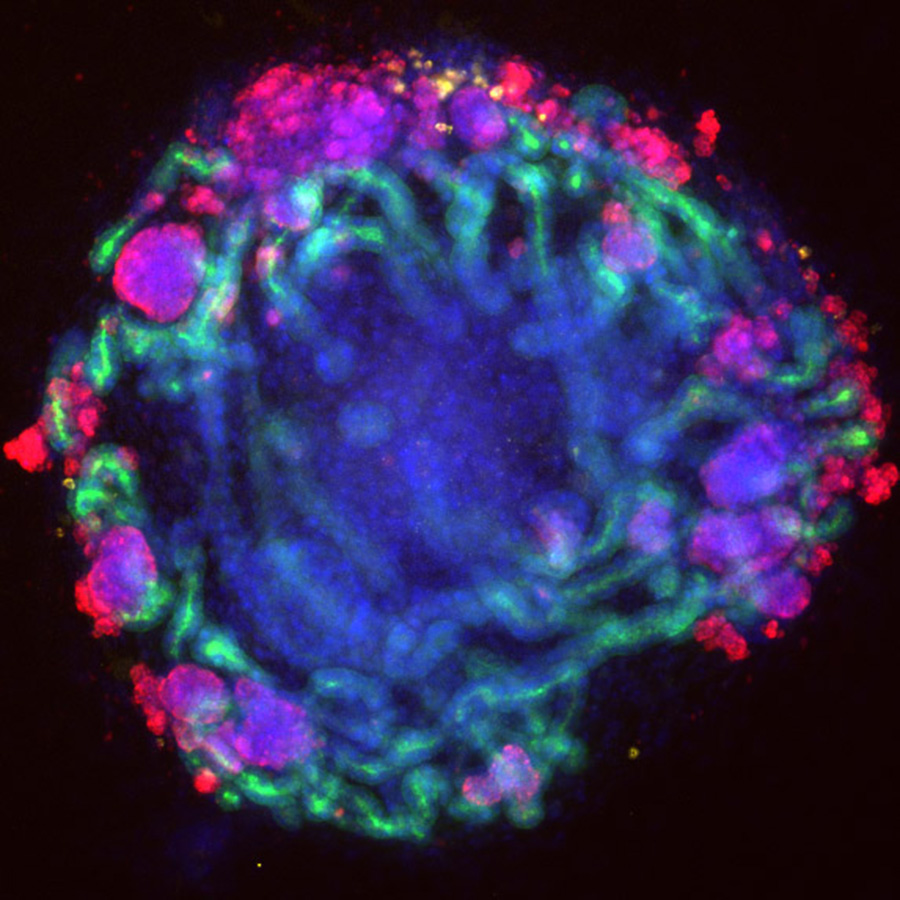 Mini-kidney organoids